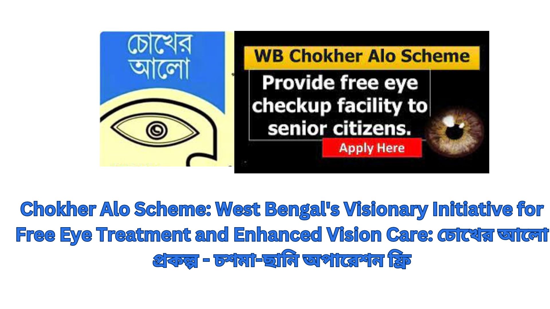 Chokher Alo Scheme: West Bengal's Visionary Initiative for Free Eye Treatment and Enhanced Vision Care: চোখের আলো প্রকল্প - চশমা-ছানি অপারেশন ফ্রি