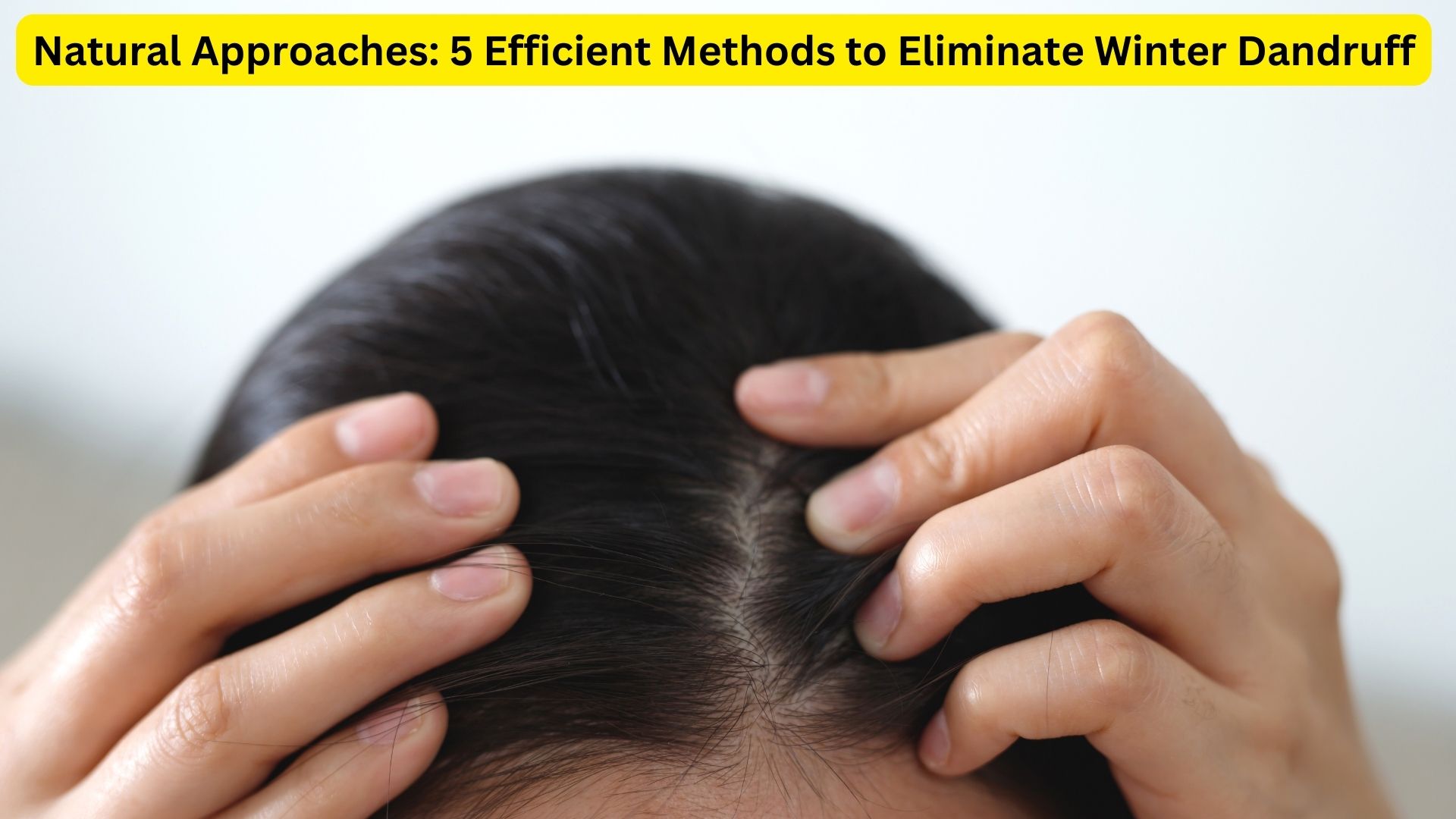 Natural Approaches: 5 Efficient Methods to Eliminate Winter Dandruff